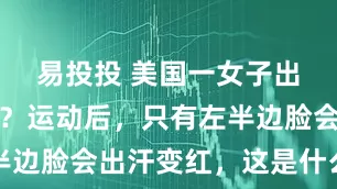 易投投 美国一女子出现阴阳脸？运动后，只有左半边脸会出汗变红，这是什么怪病